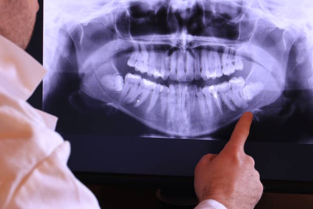 Best Emergency Tooth Extraction in Elk Creek, KY